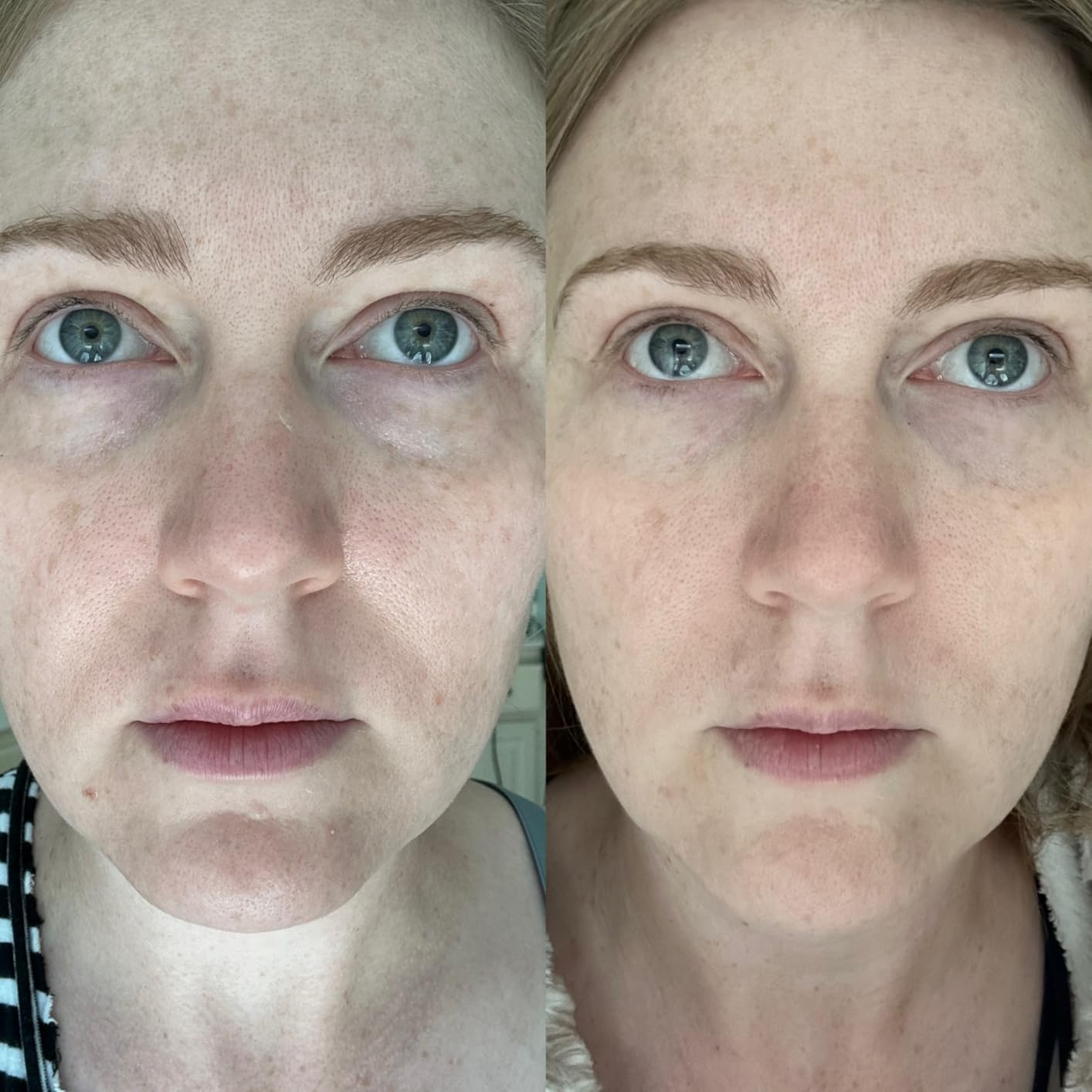 Stephen hewes