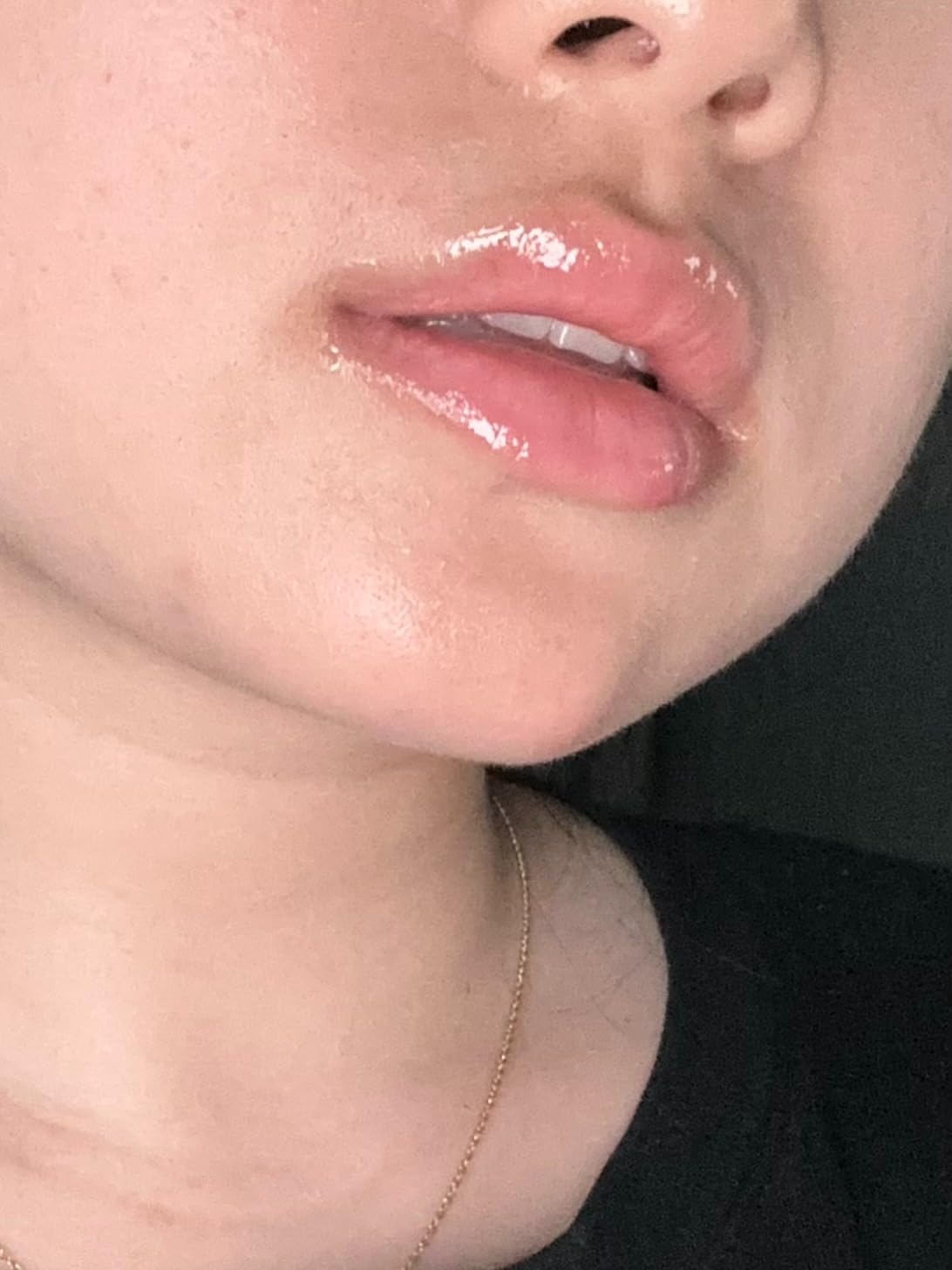 LP